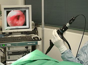 Endoscopy - Endoscopia                       